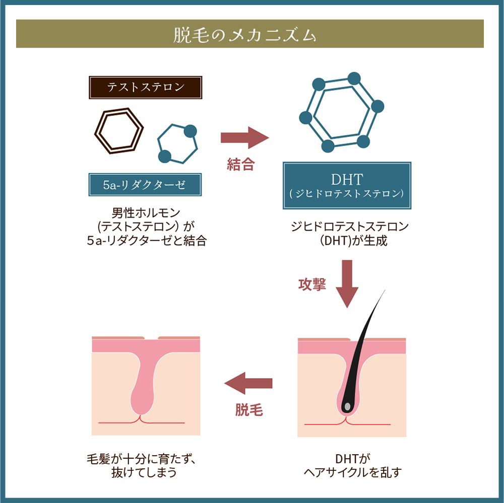 脱毛のメカニズム