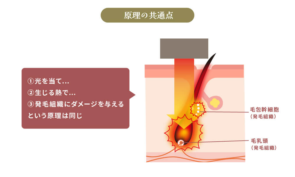 光で毛にアプローチする原理のイラスト