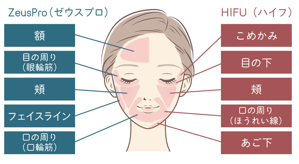 ゼウスプロに関するイラスト