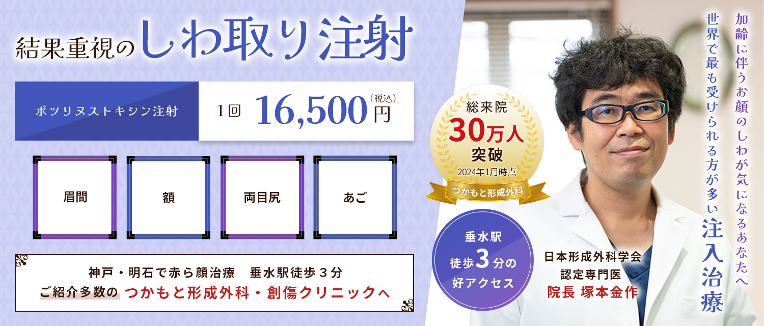 神戸市垂水区のつかもと形成外科・創傷クリニックでのボツリヌストキシン注射のバナー画像