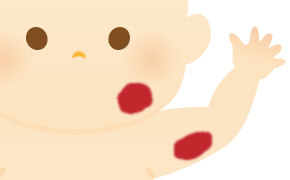 苺状血管腫のイラスト