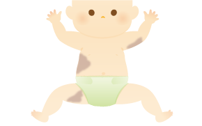 扁平母斑のイラスト