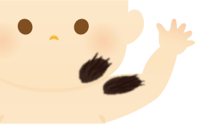 獣皮様母斑のイラスト