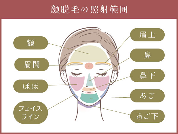 顔脱毛(医療)の照射範囲に関するイラスト