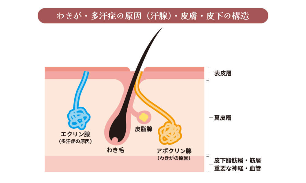 脇の多汗症の原因・皮膚・皮下の構造