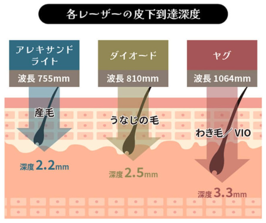 各レーザーの皮下到達深度の図
