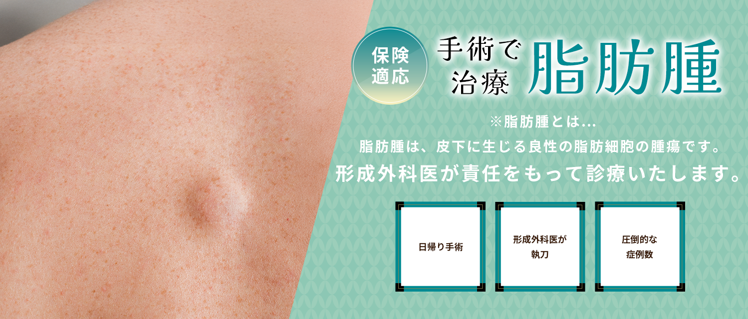 神戸で脂肪腫の治療・手術のイメージ画像
