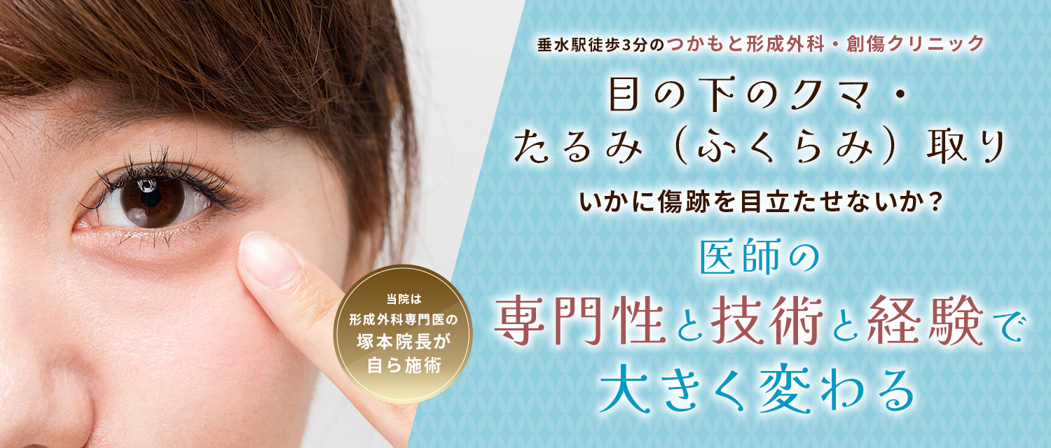 神戸で目の下のクマ・たるみ(ふくらみ)取りのファーストビュー画像