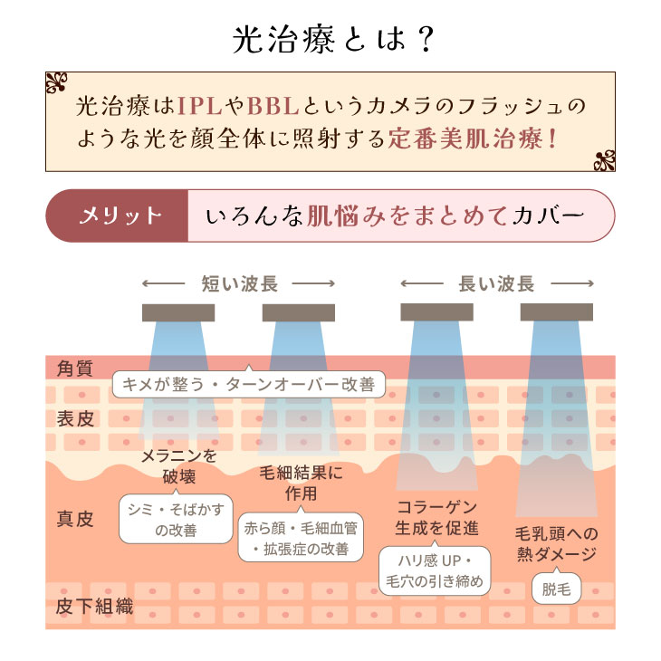 光治療とは?図