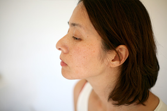 シミで悩んでいる女性