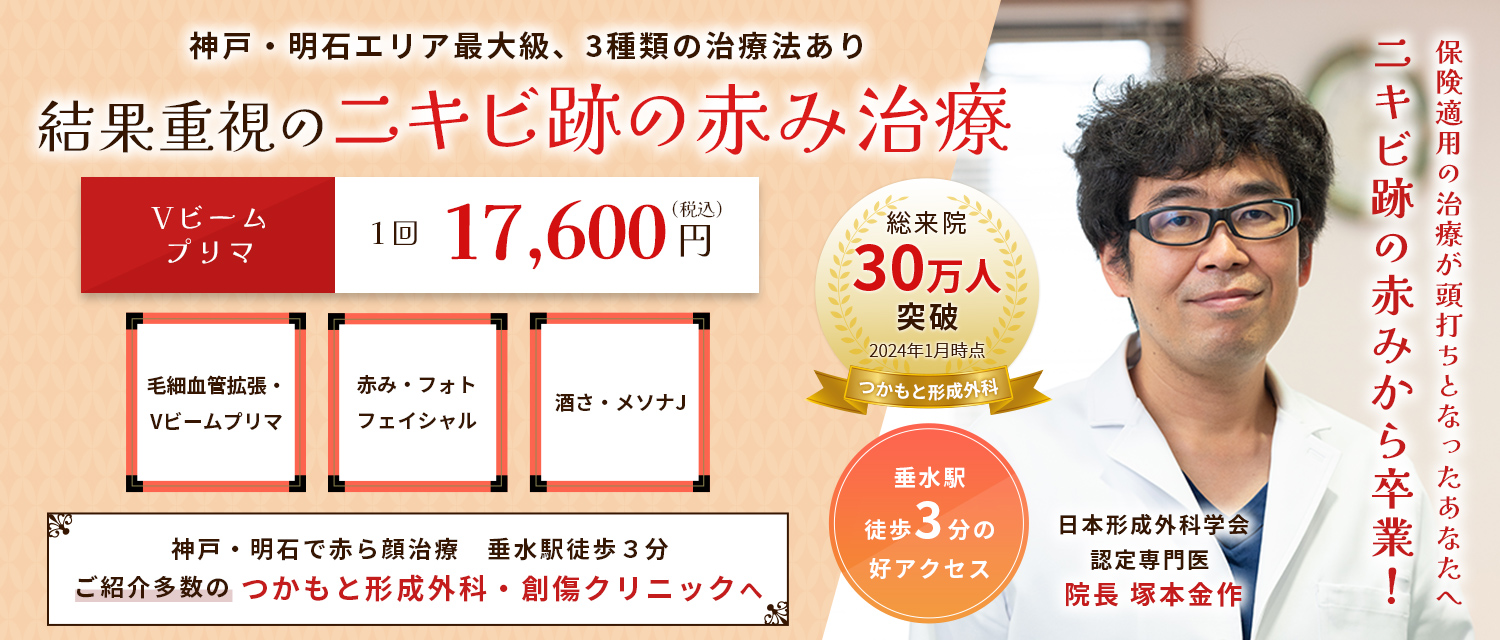 神戸市垂水区のつかもと形成外科・創傷クリニックでのニキビ跡の赤み治療のバナー画像