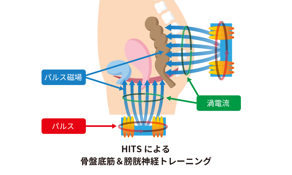 神戸市垂水区のつかもと形成外科・創傷クリニックでの骨盤底筋＆膀胱神経トレーニングの画像