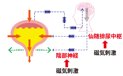 神戸で頻尿・尿もれ・過活動膀胱の改善イメージ画像