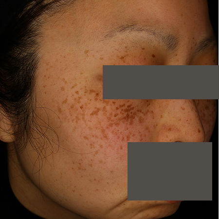 Before image