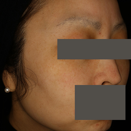 After image