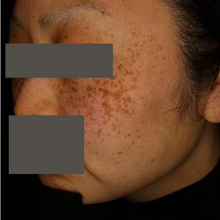 Before image