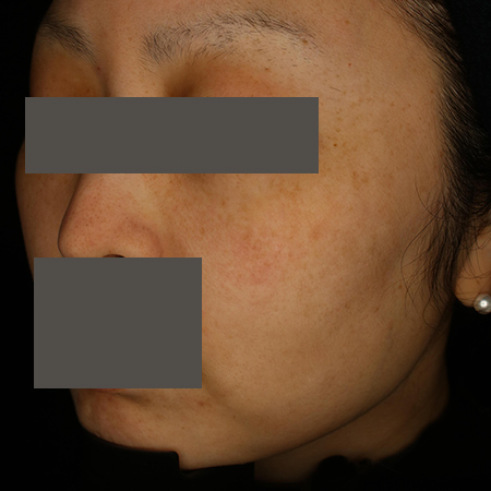 After image