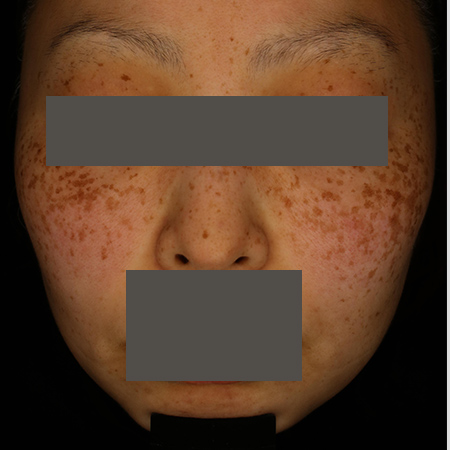 Before image