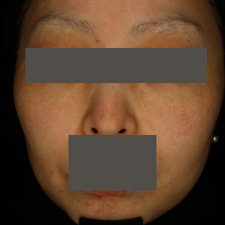 After image